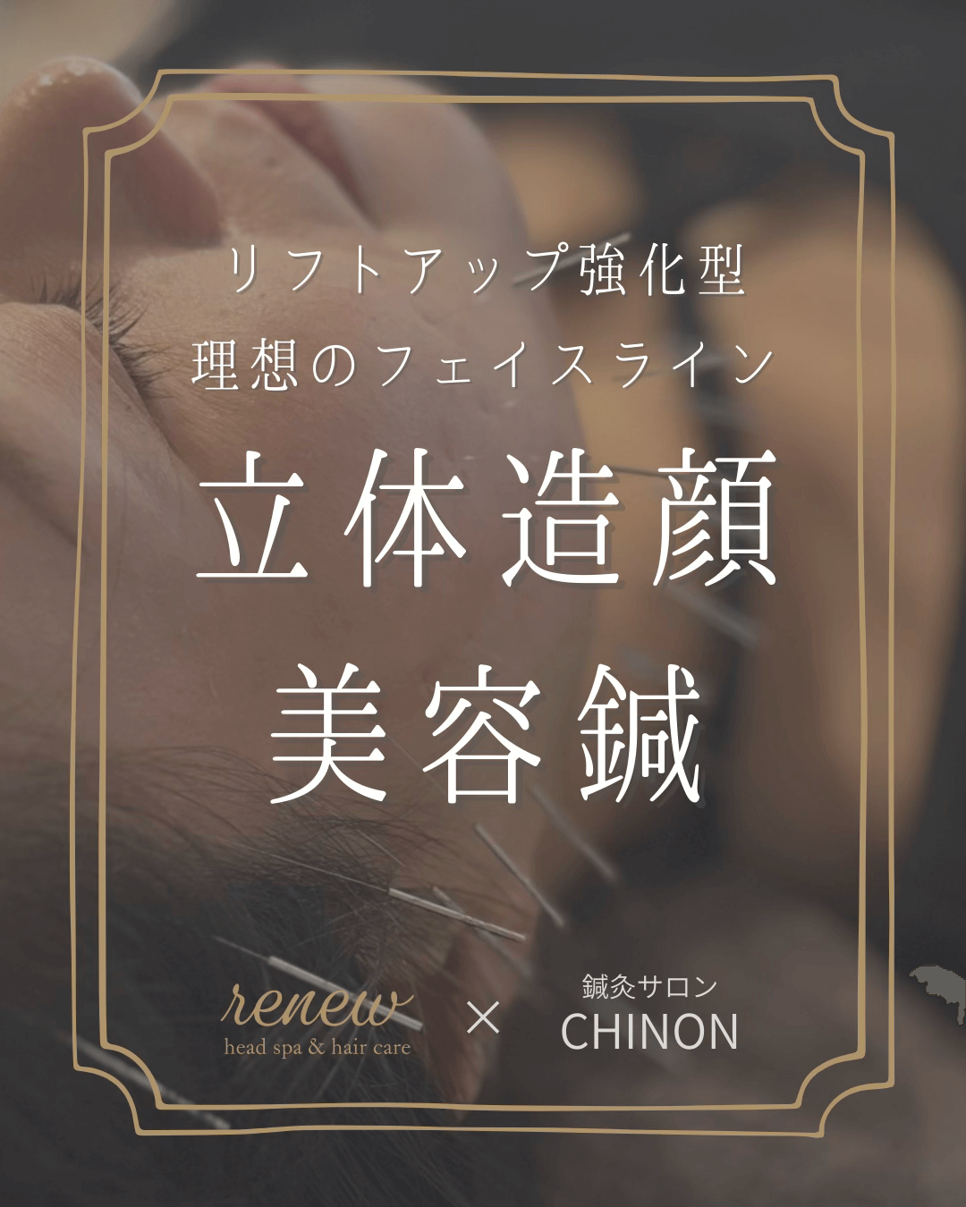 立体造顔美容鍼